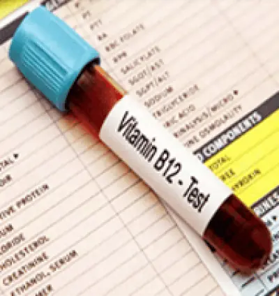 Vitamin B12 test | Vitamin D test | Dera Baba Nanak | Medical Lab in Dera Baba Nanak