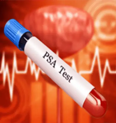 Pprostate (PSA) test in Dera Baba Nanak | Diagnosis of prostate cancer | Prostate gland