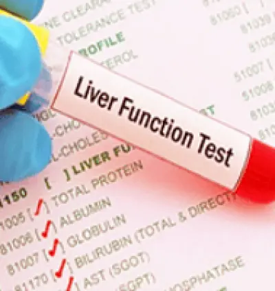 Liver function tests ( LFT ) in Dera Baba Nanak | LFT Test | liver cells damage Test
