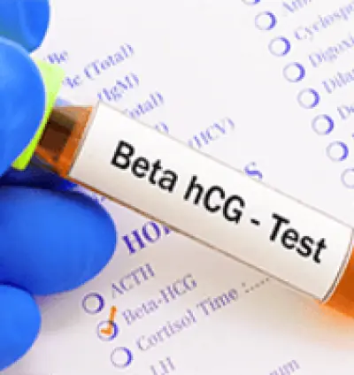 human chorionic gonadotropin (hCG) test | pregnancy test in dera baba nanak | HCG Test