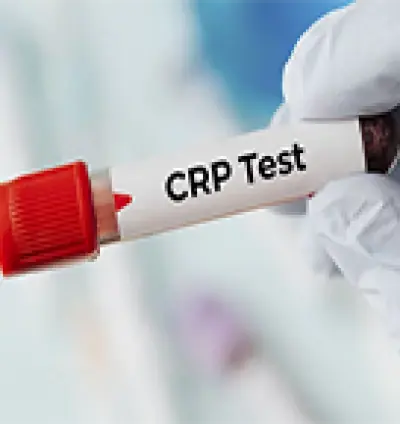 C-reactive protein (CRP) test in Dera Baba Nanak | Test Laboratory in Dera Baba Nanak Gurdaspur