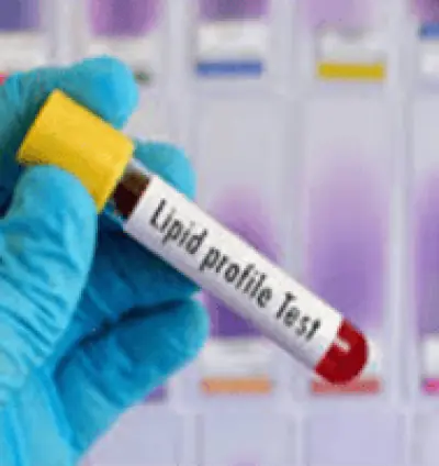 Cholesterol and lipid blood test in Dera Baba Nanak | Medical Lab in dera baba nanak Punjab