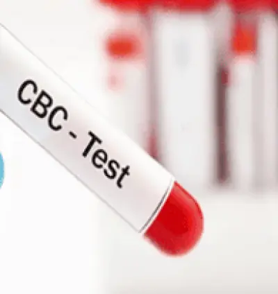Complete blood count (CBC) test in Dera Baba Nanak | Guru Nanak Diagnostic Centre Dera Baba Nanak