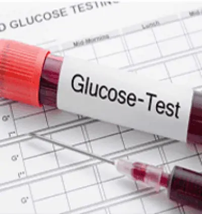 Blood glucose test in Dera Baba Nanak | Blood sugar test in Dera Baba Nanak | Guru Nanak Diagnostic